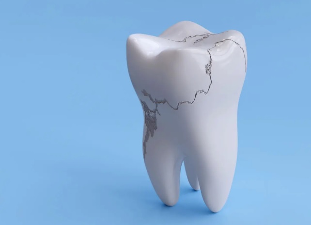 Jak rozpoznać, że szkliwo zębów wymaga odbudowy?